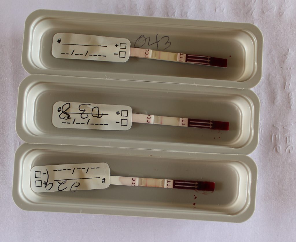 Filarial test strips showing one negative (middle) and two positive (1st and the 3rd) test results
