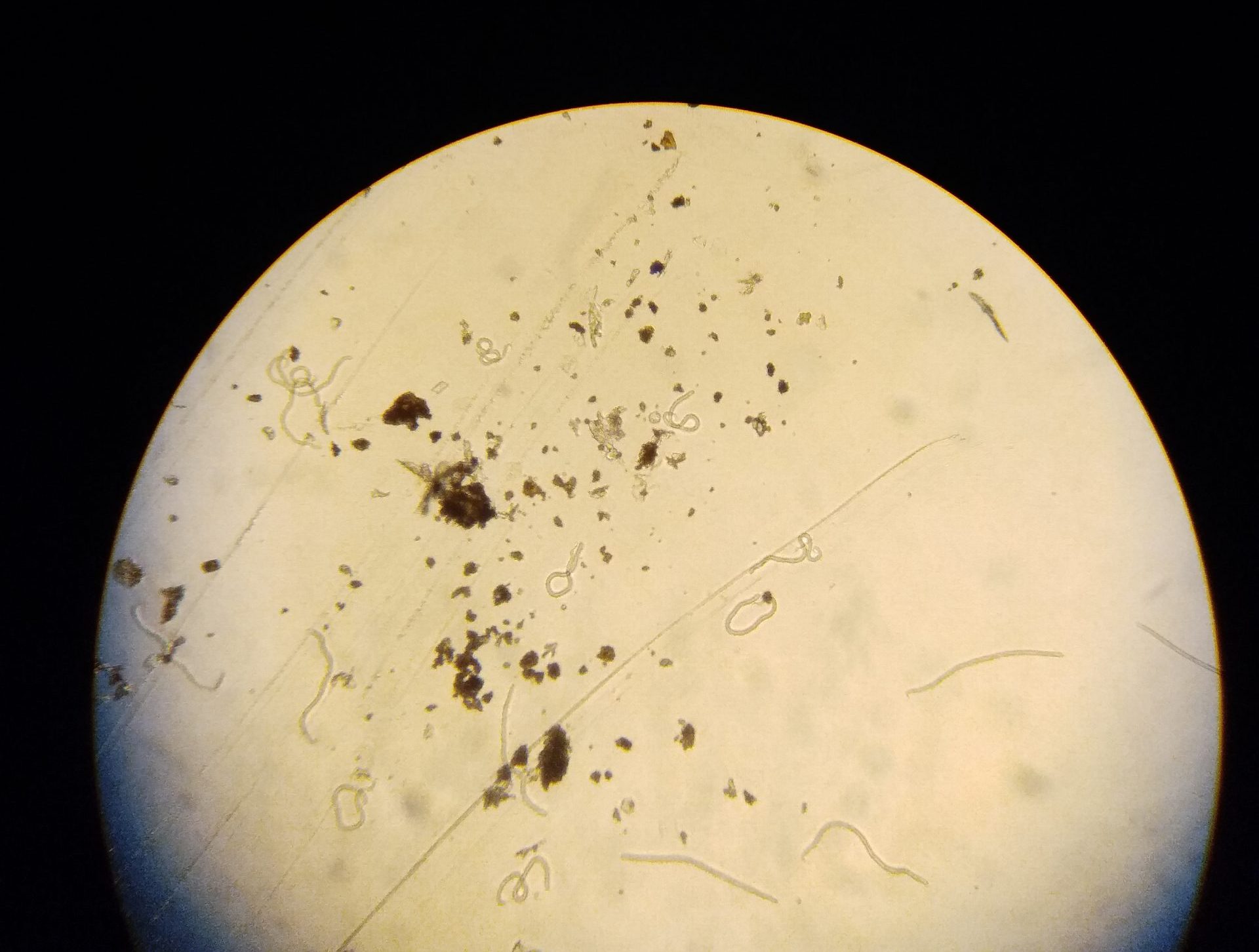 baby worms (microfilariae) of Onchocerca volvulus under the inverted microscope