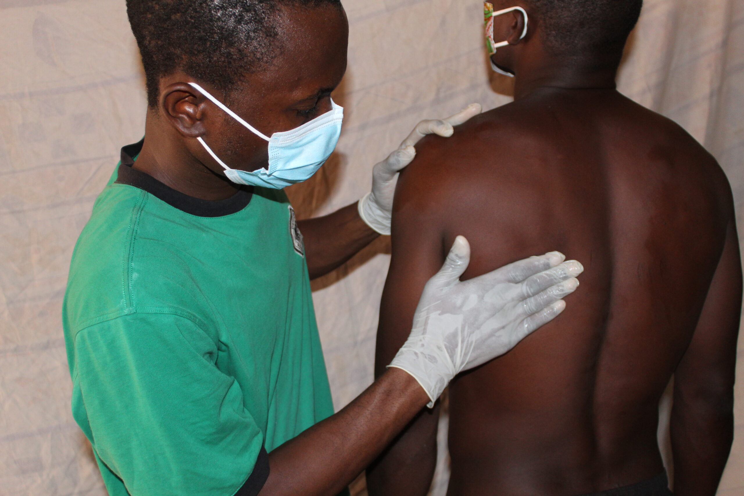Picture showing the process of palpation for onchocercal nodules