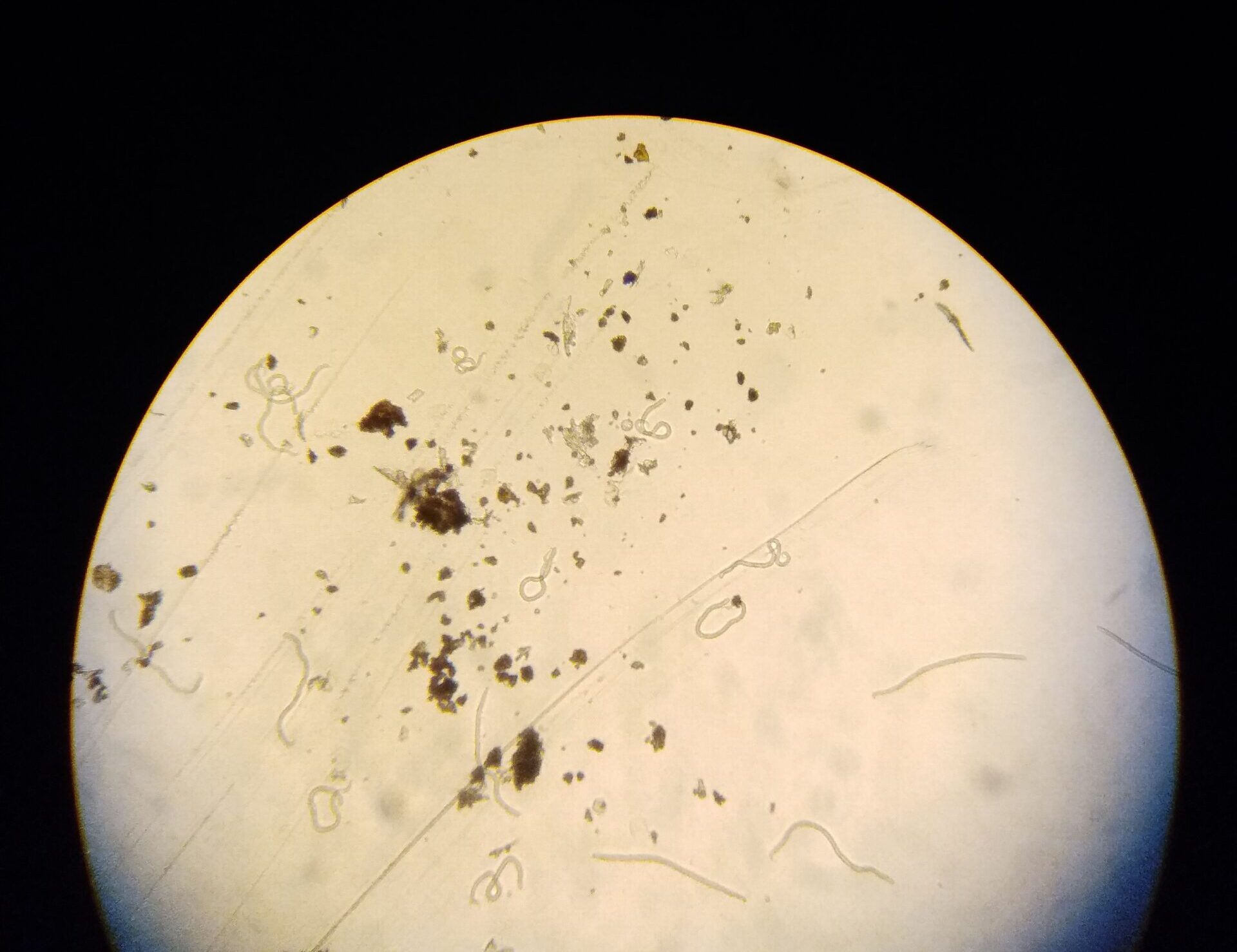 Baby worms (microfilariae) of Onchocerca volvulus under the inverted microscope